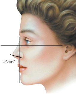 鼻唇角, 鼻中柱和嘴唇連線約為95到105度