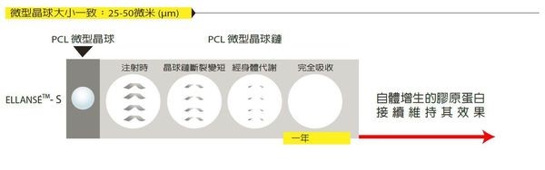 CMC凝膠體可立即填充凹陷，改善肌膚凹陷與皺紋