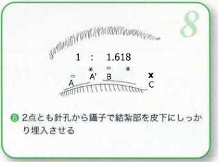 2+1訂書針縫雙眼皮 - 縫雙眼皮也有黃金比例唷