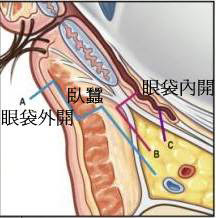 眼袋內開