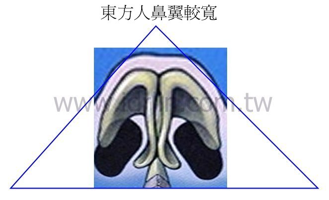 東方人鼻翼較寬