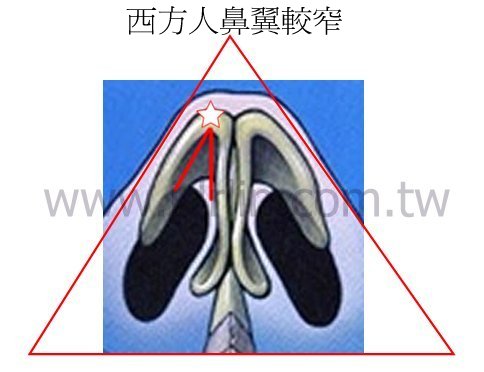 西方人鼻翼較窄