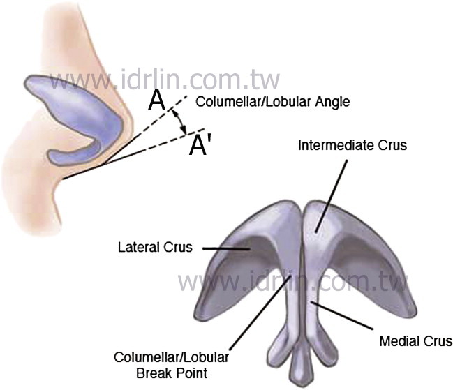 韓式隆鼻 - 鼻頭的一小步，就是鼻子美觀的一大步