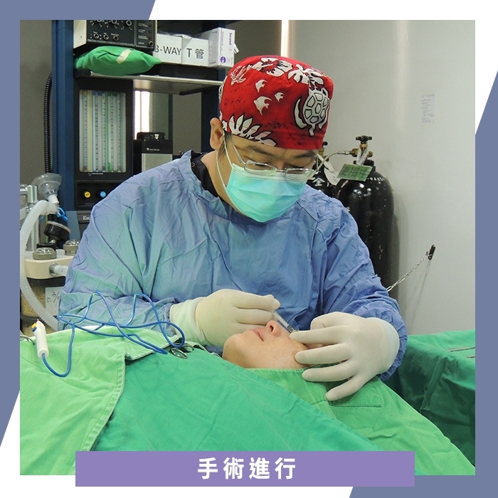 林敬鈞醫師進行複合式眼袋內開手術