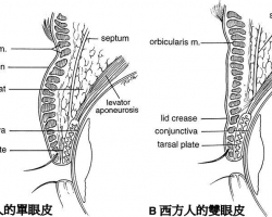 雙眼皮手術形成原理