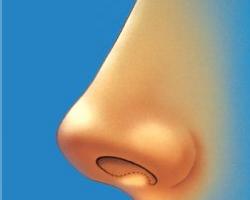 鼻子解剖